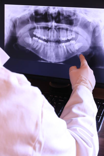 Best Emergency Gum Treatment in Iowa Falls, IA
