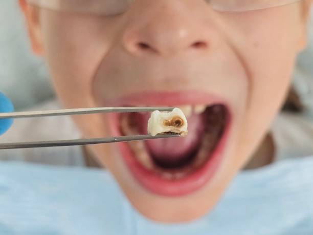 Best Cosmetic Emergency Dentistry in Iowa Falls, IA